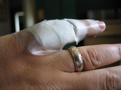 Ouch!